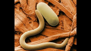 What are nematodes [upl. by Ion]