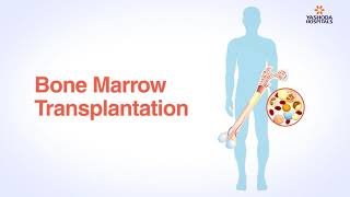 Bone Marrow Transplant Haploidentical transplant at MIOT International Hospitals [upl. by Namruht]