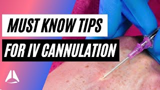 Important tips and tricks for IV cannulation [upl. by Asselam]