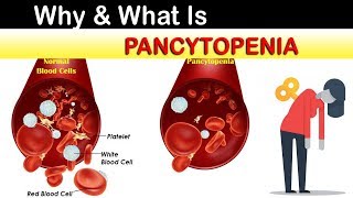 Chemotherapy in Colorectal Cancer [upl. by Thea]