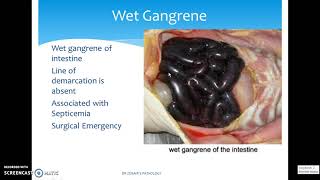 DIFFERENT TYPES OF GANGRENE [upl. by Amesari]